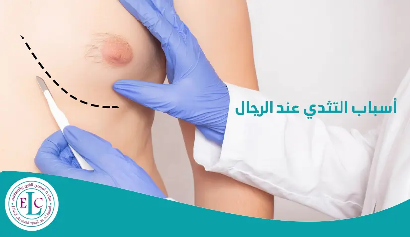 أسباب التثدي عند الرجال