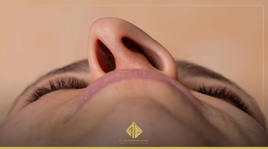 عملية اعوجاج الحاجز الانفي