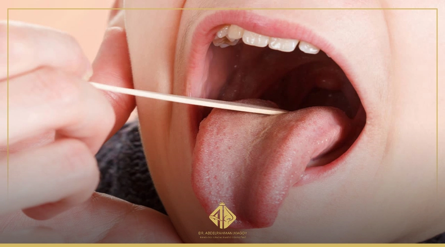 استئصال اللوز واللحمية للاطفال