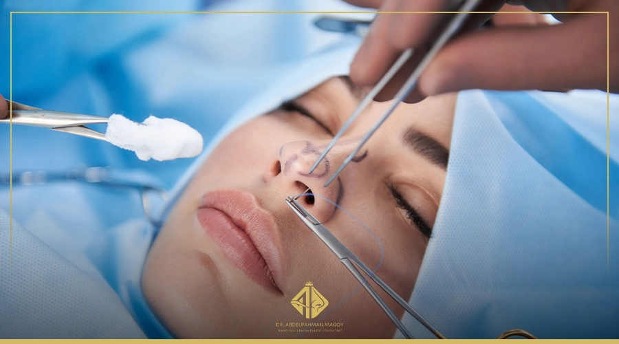 عملية استعدال الحاجز الانفى