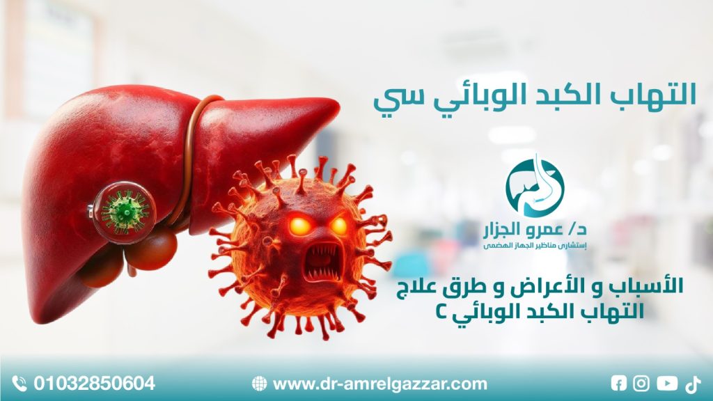 التهاب الكبد الوبائي سي