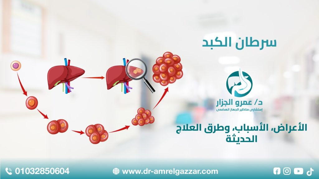 سرطان الكبد: الأعراض، الأسباب، وطرق العلاج الحديثة