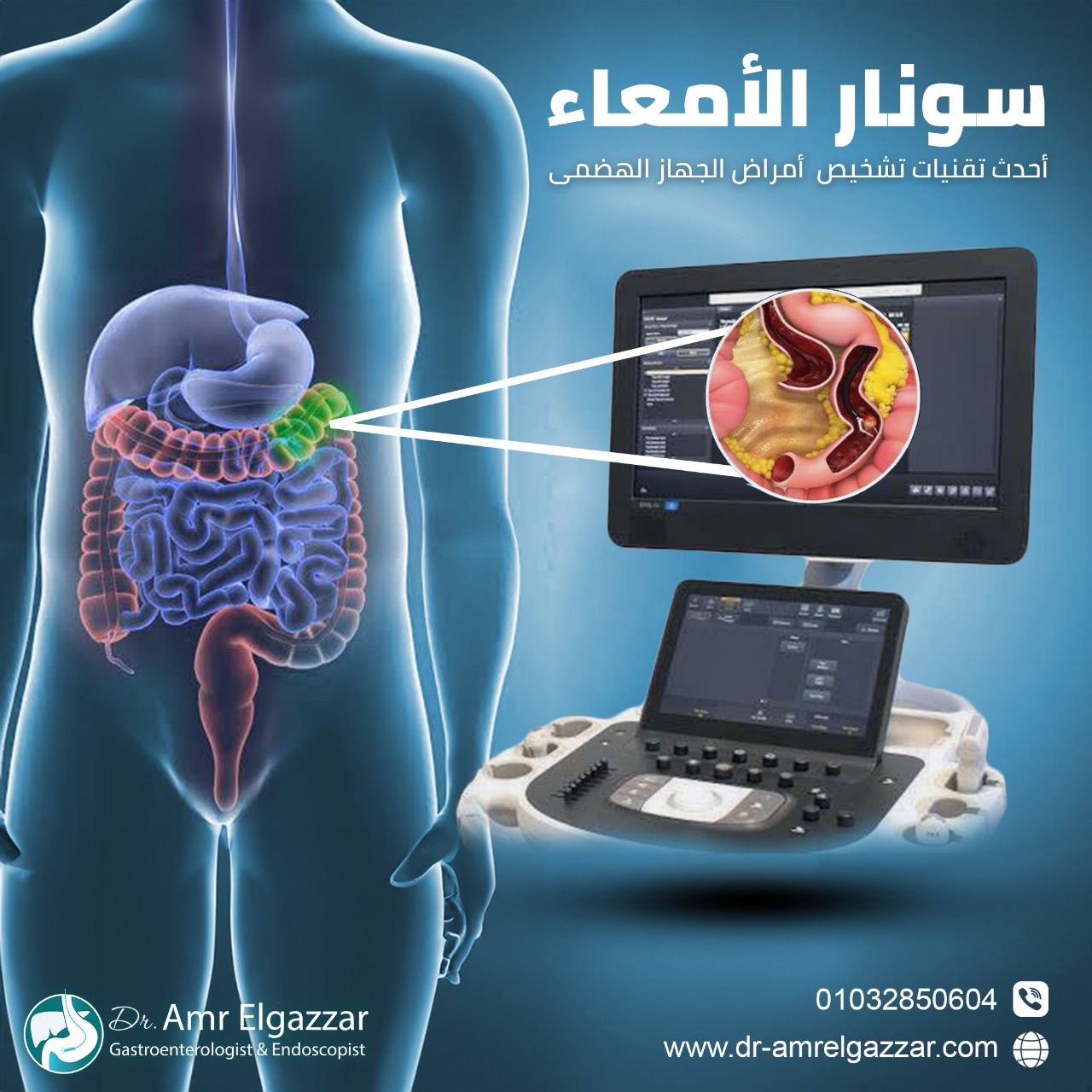 سونار الأمعاء