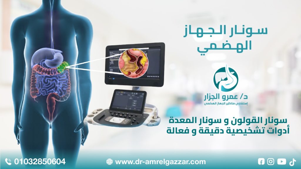 سونار المعدة