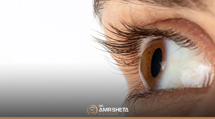 اسباب القرنية المخروطية عند الكبار والاطفال
