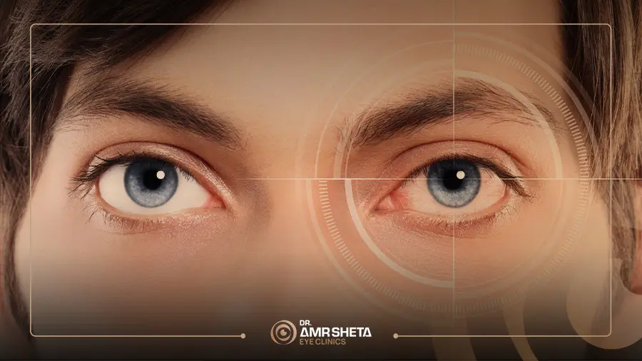 هل الاستجماتيزم يسبب الإصابة بالحول