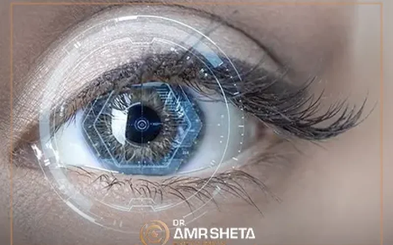 تجربتي مع عملية زراعة العدسات