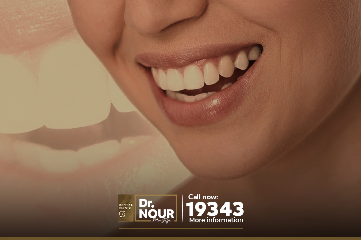 تعرف على انواع تبييض الاسنان