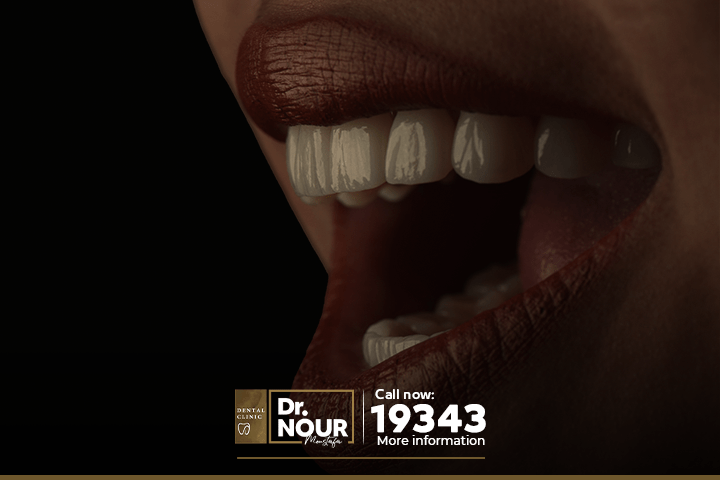 ابتسامة هوليود بدون تحضير بالنانو تكنولوجي