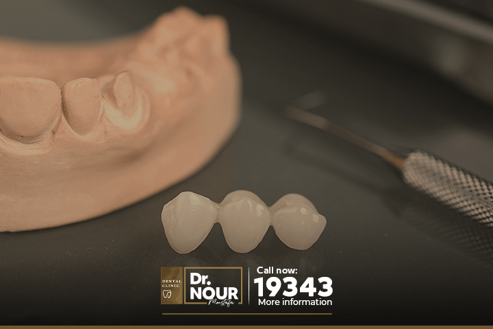 التيجان والجسور