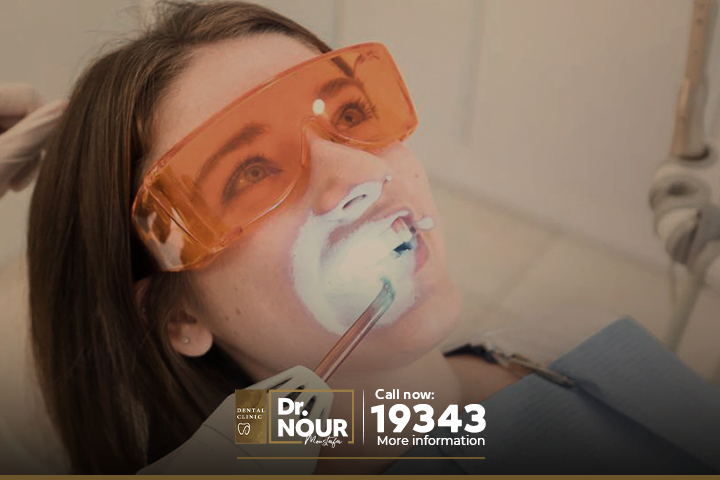 تبييض الاسنان بالليزر