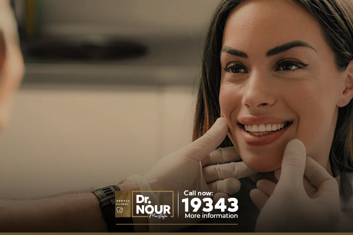 تبييض الاسنان بالفينير للحصول على ابتسامة هوليود