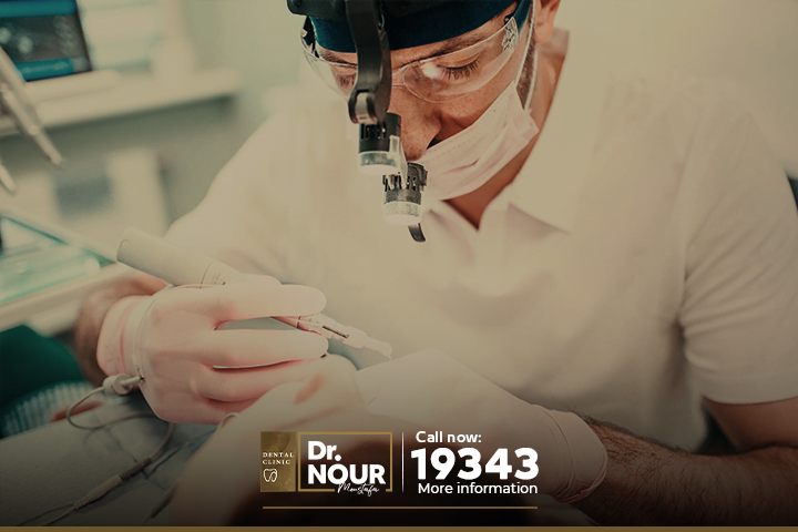 علاج الجذور