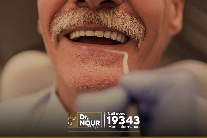 كل ما يخص زراعة الاسنان