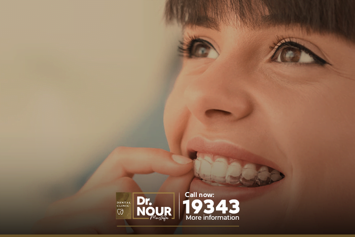 نصائح لتجميل الاسنان بالتقويم