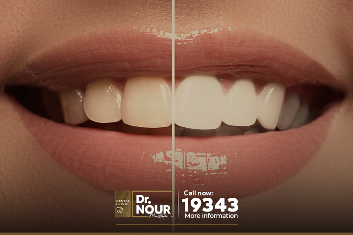 عادات اكل خاطئة للاسنان-روتين العناية بالاسنان