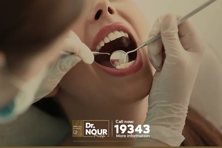 أفضل أنواع الحشوات الدائمة