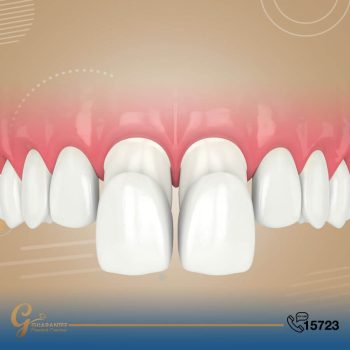 تجميل الأسنان