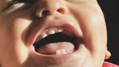 أعراض التسنين عند الرضع في الشهر الرابع