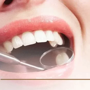 تعرف على 5 من اضرار ترك الضرس بدون حشو – احذر فالأمر خطير