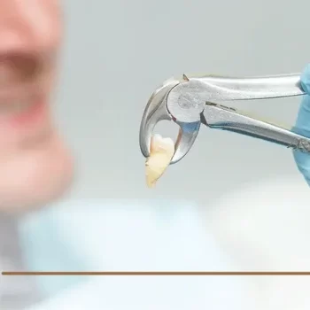 تعليمات بعد خلع الضرس