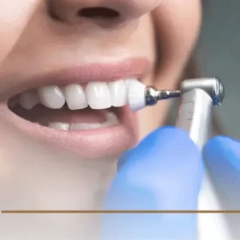 اسعار تنظيف جير الاسنان