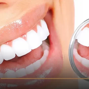 “Guarantee” Hollywood Smile Dental Center
