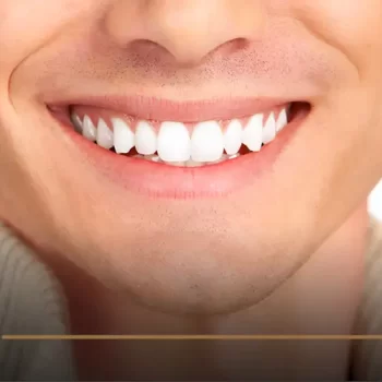 Hollywood Smile for Men: A Full Guide