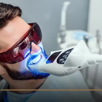 laser teeth whitening cost in egypt