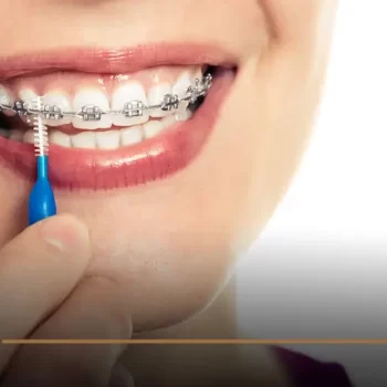 Orthodontics installation